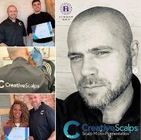 Creative Scalps Hair Clinic image 2